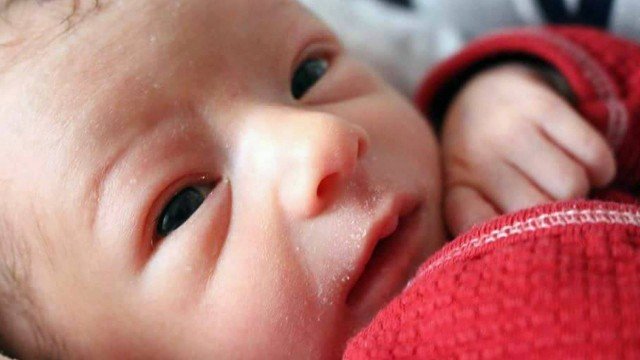 Saiba o que é a ambliopia, doença conhecida como 'olho preguiçoso'